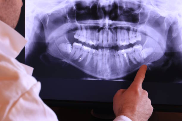 Best Pediatric Emergency Dentist in Schofield, WI