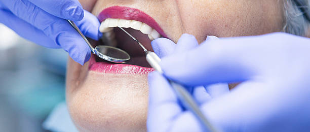 Best Emergency Dental Care for Abscessed Tooth in Schofield, WI